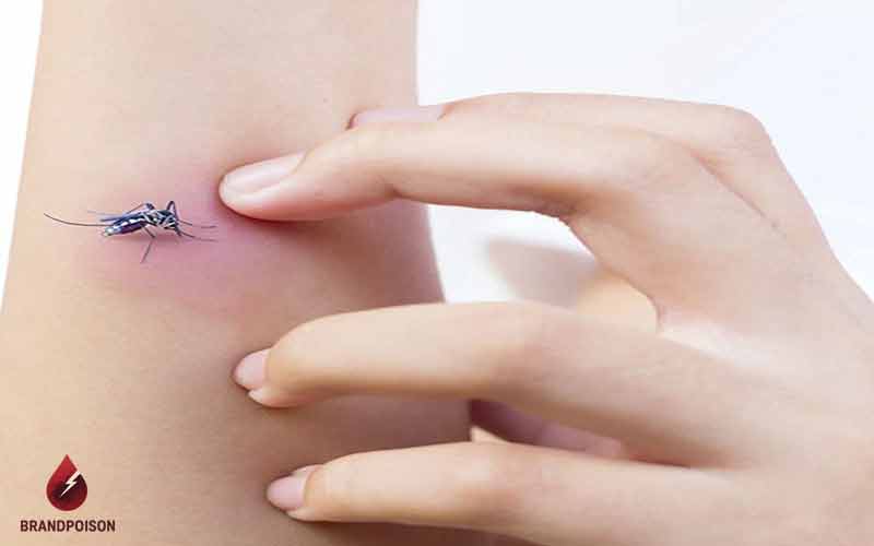 چطور میتوان نیش پشه ها را درمان کرد؟ 3 اشتباهات رایج در درمان نیش پشه